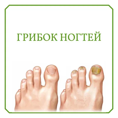 Какие болезни могут быть причиной некрасивых ногтей — Ferra.ru