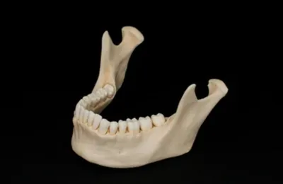 Строение нижней челюсти - нижнечелюстная кость