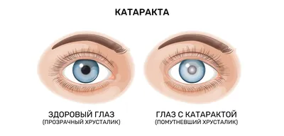 Гетерохромия глаз. Самые уникальные сочетания оттенков глаз