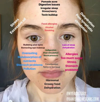 TikTok User Reveals What Moles On Face Say About Your Personality | Glamour  UK