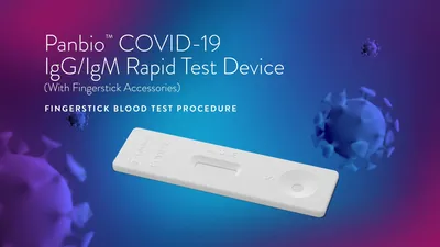 COVID-19 IgG/IgM Rapid Test Kit (Colloidal Gold) - JOYSBIO Biotechnology