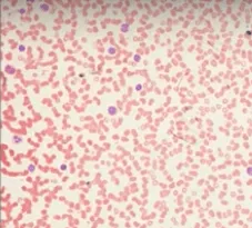 Модель человеческой клетки крови