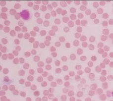 вектор клеток крови материал PNG , вектор материал, эритроцитов, Клетки  крови PNG картинки и пнг PSD рисунок для бесплатной загрузки
