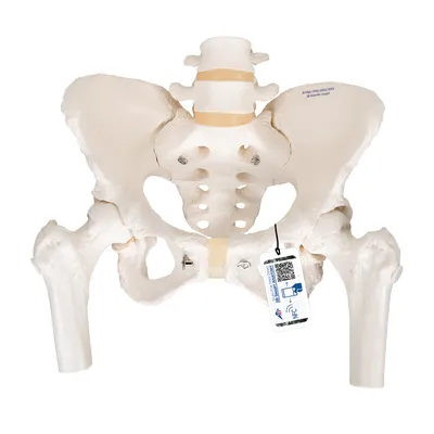 Композитная модель таза (раздел «Ортопедические модели») | Купить учебное  оборудование по доступным ценам в ПО «Зарница»