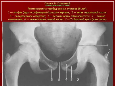 osteopat_sokolenko - Почему расходятся кости таза при беременности?  Лобковая кость, в которой и возникают дискомфортные ощущения, состоит из  верхних ветвей двух лонных костей, подвижно соединенных между собой  хрящевой связкой (симфизом). Образуемое лонными