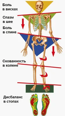 Основы. КСС. Таз. Лучевая анатомия таза. + | Портал радиологов