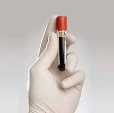 Органы животной крови заполненные Стоковое Изображение - изображение  насчитывающей горизонтально, природа: 61377161