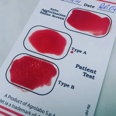 Донор крови в 2023: выплаты и льготы, как и кто может стать почетным  донором, сколько крови сдавать | Банки.ру