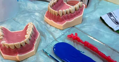 Виды протезирования зубов - Стоматологическая клиника VИТАЛЬ