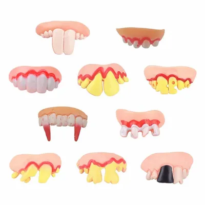Случай из практики: аплазия постоянных зубов | Записки Честного Стоматолога  | Дзен