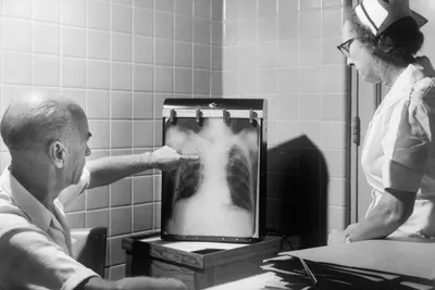 Рентген (рентгенодиагностика): показания, противопоказания, опасность |  Клиника Эксперт