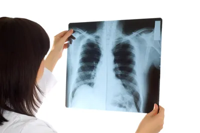 История X-лучей от Рентгена до Кюри: кто открыл рентгеновское излучение,  как выглядел первый рентгеновский снимок, почему пациенты умирали от  облучения и какие ученые внесли вклад в развитие рентгенологии
