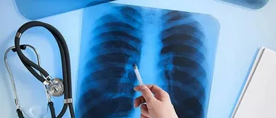 День Рентгенолога 8 Ноября Открытка | TikTok