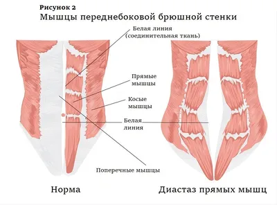 Лимфатические узлы брюшной полости. Часть 1. 2022 08 10 10 07 42 - YouTube