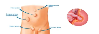 Анатомия человека. Строение и расположение внутренних органов человека.  Органы грудной клетки, брюшной полости, … | Анатомия, Анатомия человека,  Учащиеся медучилища