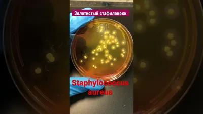 Золотистый стафилококк - Staphylococcus aureus. Рост в чашке Петри на  питательной среде - YouTube