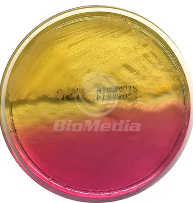 Золотистый стафилококк - Staphylococcus aureus. Рост в чашке Петри на  питательной среде. Видео LINCO Platform