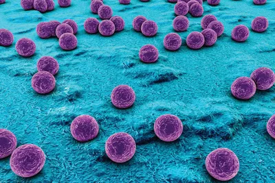 Ученые выяснили, что золотистый стафилококк можно вылечить пробиотиками  вместо антибиотиков - Газета.Ru | Новости