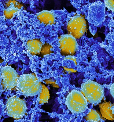 Оружие против устойчивого к антибиотикам золотистого стафилококка нашли в  других бактериях