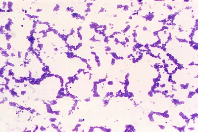 ПЦР-диагностика золотистого стафилококка. Качественно, количественно и  выявление метициллин-чувствительного Staphylococcus aureus | ВИРА-Центр г.  Нефтеюганск