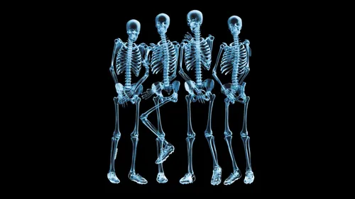 Скелеты Обои на телефон группа человеческих скелетов