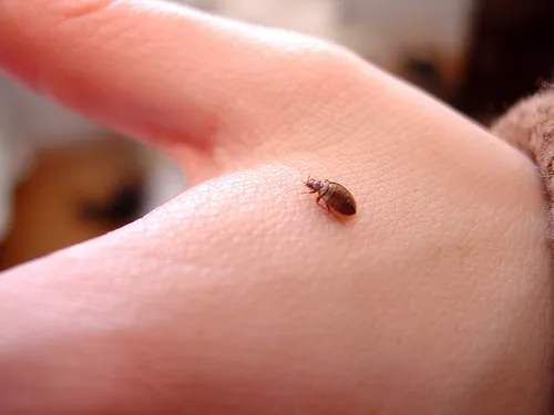 Вши Фото маленькое насекомое на пальце человека