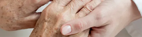 Кератома Фото рука человека крупным планом
