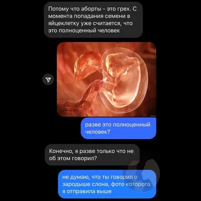 Медикаментозный аборт в Беларуси. Где сделать? Какие последствия? |  Консультация гинеколога в Минске DOKTORA.BY