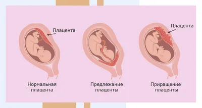 Аксенов заявил об отсутствии планов запретить аборты в Крыму — РБК