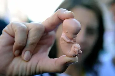 Медикаментозный аборт - Сделать в Ростове-на-дону. Без операции в больнице  СКЖД Батайска