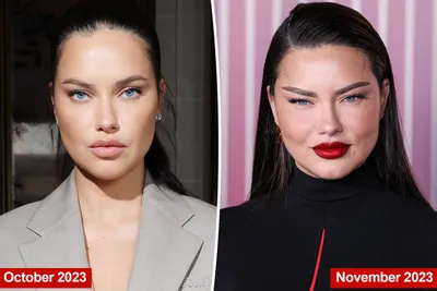 Adriana Lima Slams Plastic Surgery Rumors With Witty Response - Sports  Illustrated Lifestyle