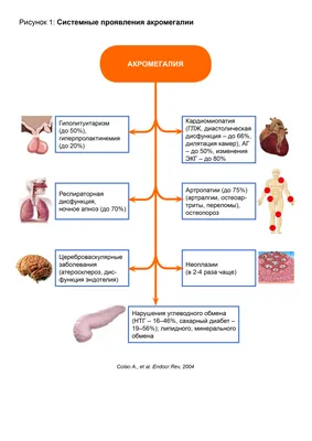 Пальцы становились кривыми, руки — огромными, нога выросла с 37-го до 41-го  размера». Как живут и борются за лекарства люди с акромегалией | Такие дела  Такие дела