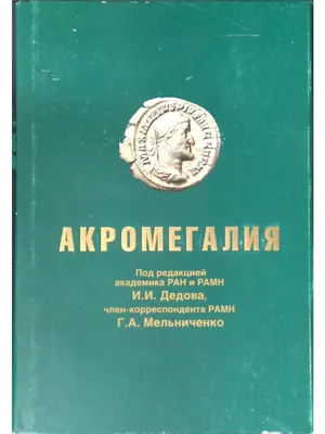 Акромегалия: признаки и причины болезни | InvaNews