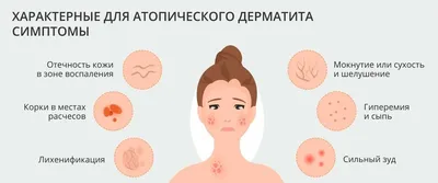https://www.laroche-posay.ru/blog/allergiya-na-lice