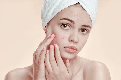 Аллергия на коже – что делать, симптомы, как лечить