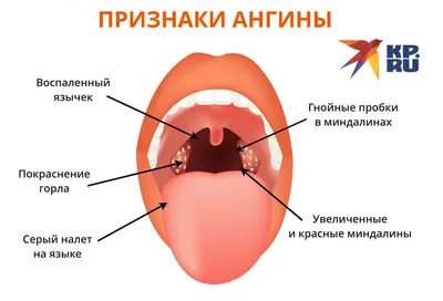 Ангина: истории из жизни, советы, новости, юмор и картинки — Все посты |  Пикабу