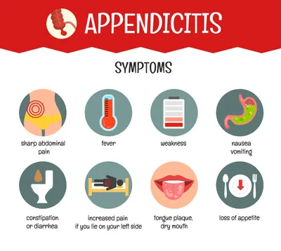 Аппендицит: симптомы у взрослых и детей | Диагностика и лечение аппендицита  в АО «Медицина»