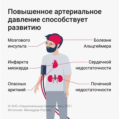 Артериальная гипертензия: болезнь 21-го века, лечение в Нижнем Новгороде |  ТОНУС ЛАЙФ