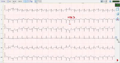 https://policlinika.com.ua/ru/blog/arterialna-gipertenziya-shho-potribno-znaty-pro-tyhogo-vbyvtsyu/