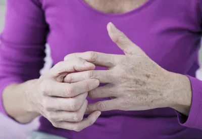 Ревматоидный артрит: что за болезнь, осложнения