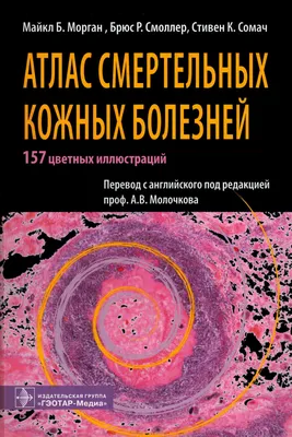 Атлас смертельных кожных болезней - купить с доставкой по выгодным ценам в  интернет-магазине OZON (610821934)