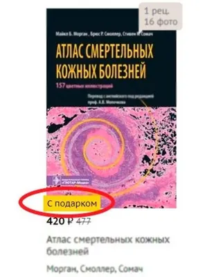 Потекаев Николай Николаевич, Акимов Всеволод Георгиевич. Дифференциальная  диагностика и лечение кожных болезней. Атлас-справочник — купить в  интернет-магазине по низкой цене на Яндекс Маркете