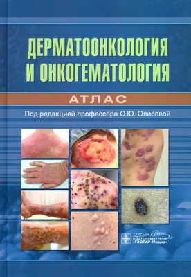 Кожные и венерические болезни. Атлас: Учебное пособие — купить книги на  русском языке в DomKnigi в Европе