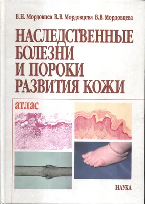 Купить Клинический атлас заболеваний кожи по Эндрюсу. Джеймс Уильям Д.  (7085151) в Крыму, цены, отзывы, характеристики | Микролайн
