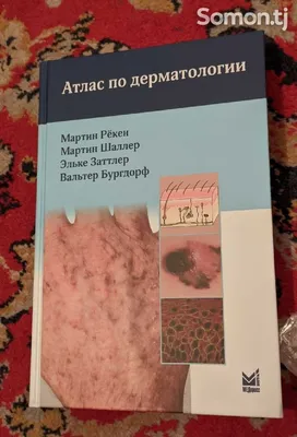 Наследственные болезни и пороки развития кожи: Клиника. Морфология.  Лечение: Атлас - «Академкнига». Официальный интернет-магазин и сайт сети  магазинов