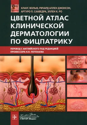 Книга «Будни дерматолога. Атлас и текст»