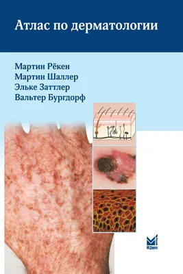 Атлас аллергических болезней. Краткое иллюстрированное руководство  Ненашева, Бодня, Терехова 9785604497548