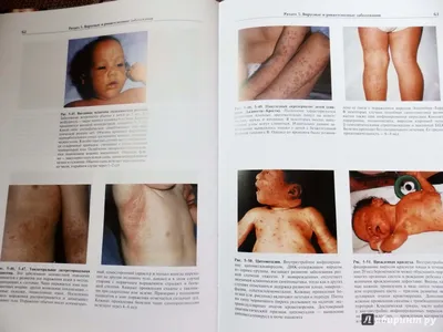 Коллеги, решил провести розыгрыш двух книг: 1️⃣ Атлас смертельных кожных  болезней. 2️⃣ Кожные болезни в акушерской и гинекологической… | Instagram