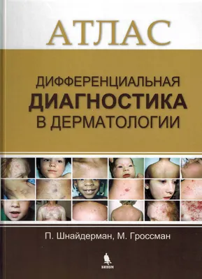 Кожные и венерические болезни. Атлас: Учебное пособие — купить книги на  русском языке в DomKnigi в Европе