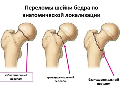 Человек Колено Анатомия С Бедра, Голени И Малоберцовой Костей Под  Рентгеновскими Лучами, Изолированных На Черном. Фотография, картинки,  изображения и сток-фотография без роялти. Image 33002987